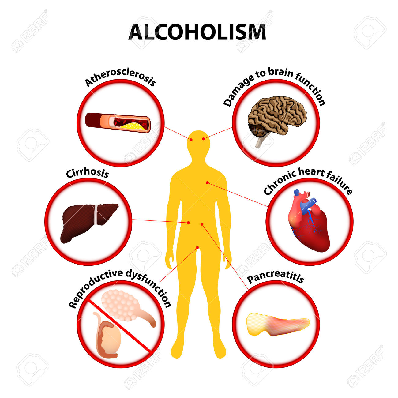 alcohol-health-problems-and-symptoms-of-use-abuse-drug