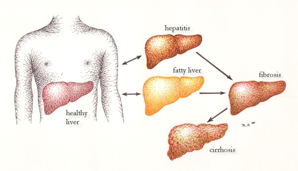 does aspirin affect other medications