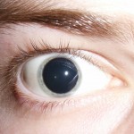 Dilated pupils from methamphetamine