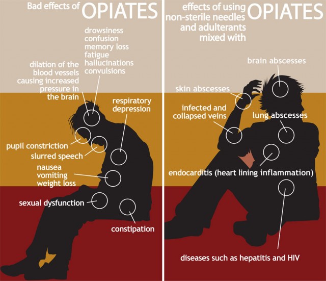 Bad Effects of Opiates. Effects on the body.
